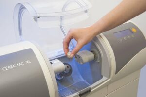 CEREC treatment videos are more compelling than a still image of a crown mill.